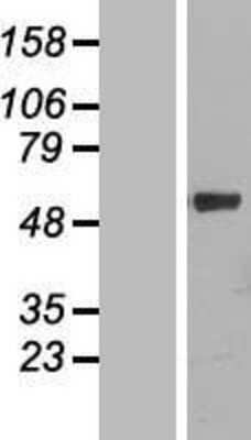 Western Blot: Cytochrome P450 4F11 Overexpression Lysate [NBL1-09697]