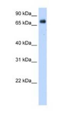 Western Blot: POR/Cytochrome P450 Reductase Antibody [NBP1-59780]