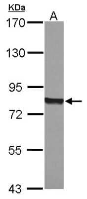 Western Blot: POR/Cytochrome P450 Reductase Antibody [NBP2-16083]