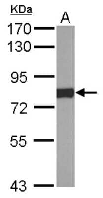 Western Blot: POR/Cytochrome P450 Reductase Antibody [NBP2-16083]