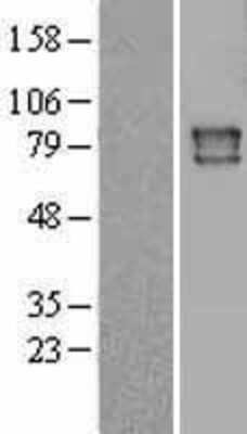 Western Blot: POR/Cytochrome P450 Reductase Overexpression Lysate [NBL1-14611]