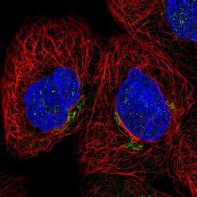 Immunocytochemistry/ Immunofluorescence: Cytochrome b reductase 1 Antibody [NBP2-58323]