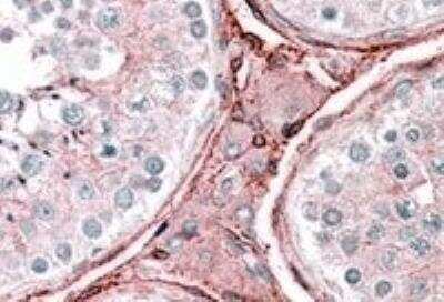 Immunohistochemistry-Paraffin: Cytochrome b reductase 1 Antibody [NB300-914]