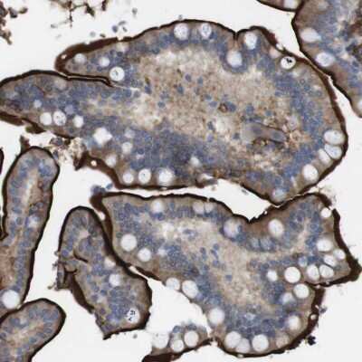 Immunohistochemistry-Paraffin: Cytochrome b reductase 1 Antibody [NBP1-84291]