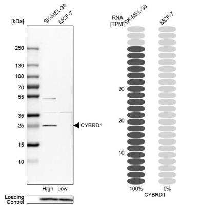 Western Blot: Cytochrome b reductase 1 Antibody [NBP1-84291]