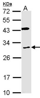 Western Blot: Cytochrome b reductase 1 Antibody [NBP2-16075]