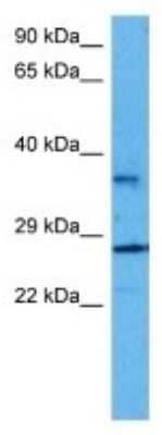 Western Blot: Cytochrome b reductase 1 Antibody [NBP3-10801]