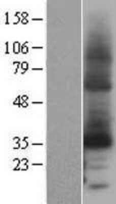 Western Blot: Cytochrome b reductase 1 Overexpression Lysate [NBL1-09660]