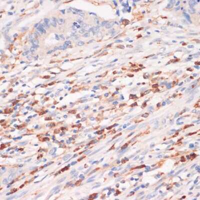 Immunohistochemistry-Paraffin: Cytochrome b245 alpha Antibody - BSA Free [NBP3-03403]