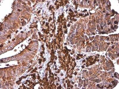 Immunohistochemistry-Paraffin: Cytochrome b245 alpha Antibody [NBP3-13323]