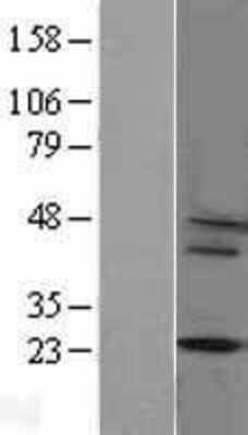 Western Blot: Cytochrome b245 alpha Overexpression Lysate [NBL1-09657]