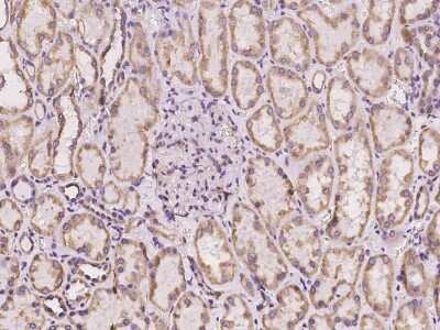 Immunohistochemistry: Cytochrome b5 Outer Mitochondrial Membrane Antibody [NBP2-97403]