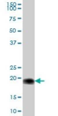 Western Blot: Cytochrome b5 Outer Mitochondrial Membrane Antibody [H00080777-B01P]