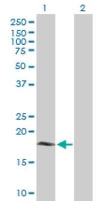 Western Blot: Cytochrome b5 Outer Mitochondrial Membrane Antibody [H00080777-B01P]