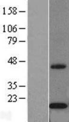 Western Blot: Cytochrome b5 Outer Mitochondrial Membrane Overexpression Lysate [NBL1-09652]