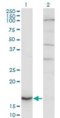 Western Blot: Cytochrome b5 type A Antibody (1A8) [H00001528-M06]