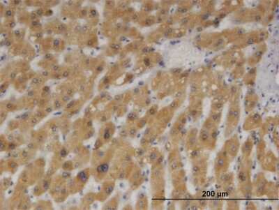 Immunohistochemistry-Paraffin: Cytochrome b5 type A Antibody (4C2) [H00001528-M05]