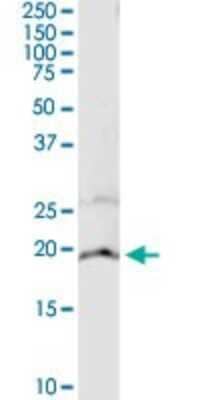 Western Blot: Cytochrome b5 type A Antibody (4C2) [H00001528-M05]