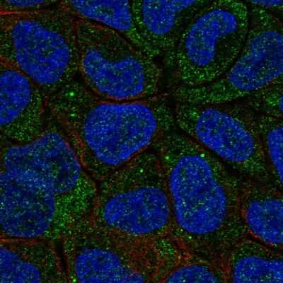 Immunocytochemistry/ Immunofluorescence: Cytochrome b5 type A Antibody [NBP2-48877]