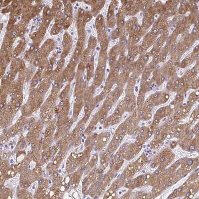 Immunohistochemistry-Paraffin: Cytochrome b5 type A Antibody [NBP2-48877]