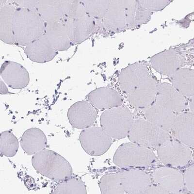 Immunohistochemistry-Paraffin: Cytochrome b5 type A Antibody [NBP2-48877]