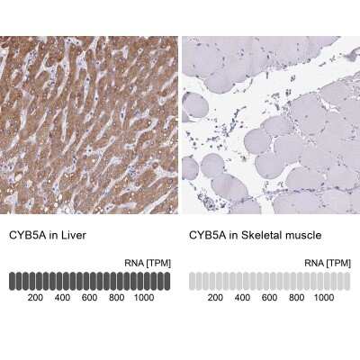 Immunohistochemistry-Paraffin: Cytochrome b5 type A Antibody [NBP2-48877]