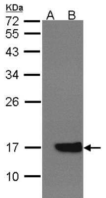 Western Blot: Cytochrome b5 type A Antibody [NBP2-14923]