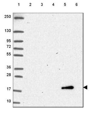 Western Blot: Cytochrome b5 type A Antibody [NBP2-49284]