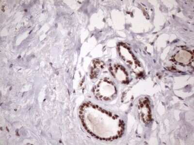 Immunohistochemistry: LIPT2-AS1 Antibody (OTI4C7) [NBP2-45841]