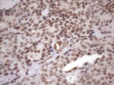Immunohistochemistry: LIPT2-AS1 Antibody (OTI4C7) [NBP2-45841]
