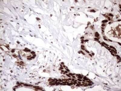 Immunohistochemistry: LIPT2-AS1 Antibody (OTI4C7) [NBP2-45841]