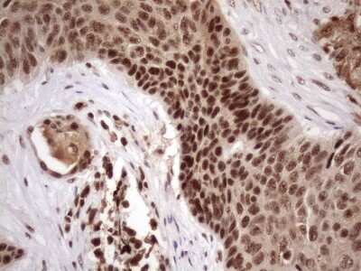 Immunohistochemistry: LIPT2-AS1 Antibody (OTI4C7) [NBP2-45841]