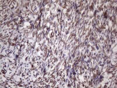 Immunohistochemistry: LIPT2-AS1 Antibody (OTI4C7) [NBP2-45841]