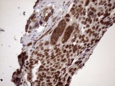 Immunohistochemistry: LIPT2-AS1 Antibody (OTI4C7) [NBP2-45841]