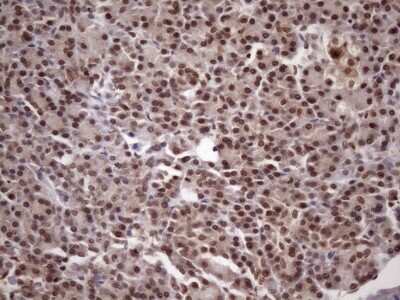 Immunohistochemistry: LIPT2-AS1 Antibody (OTI4C7) [NBP2-45841]