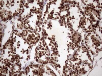 Immunohistochemistry: LIPT2-AS1 Antibody (OTI4C7) [NBP2-45841]