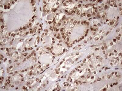 Immunohistochemistry: LIPT2-AS1 Antibody (OTI4C7) [NBP2-45841]