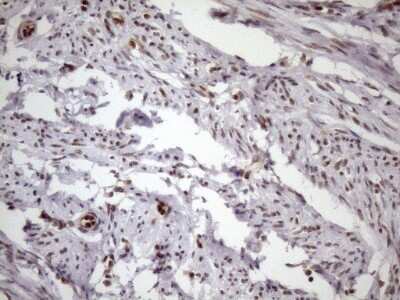 Immunohistochemistry: LIPT2-AS1 Antibody (OTI4C7) [NBP2-45841]