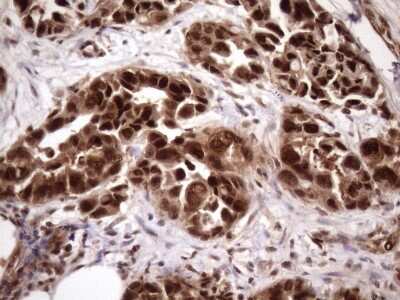 Immunohistochemistry: LIPT2-AS1 Antibody (OTI4C7) [NBP2-45841]