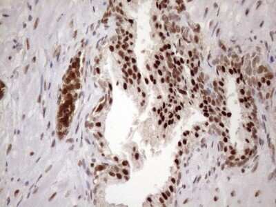 Immunohistochemistry: LIPT2-AS1 Antibody (OTI4C7) [NBP2-45841]