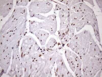 Immunohistochemistry: LIPT2-AS1 Antibody (OTI4C7) [NBP2-45841]