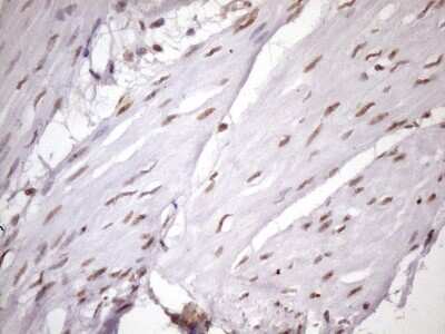 Immunohistochemistry: LIPT2-AS1 Antibody (OTI4C7) [NBP2-45841]