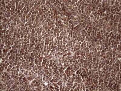 Immunohistochemistry: LIPT2-AS1 Antibody (OTI4C7) [NBP2-45841]