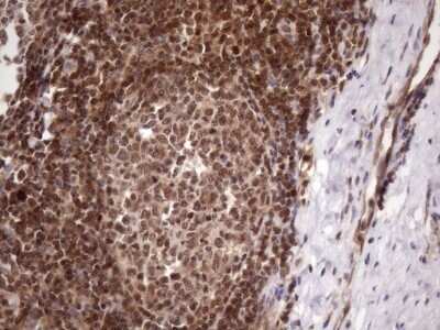 Immunohistochemistry: LIPT2-AS1 Antibody (OTI4C7) [NBP2-45841]