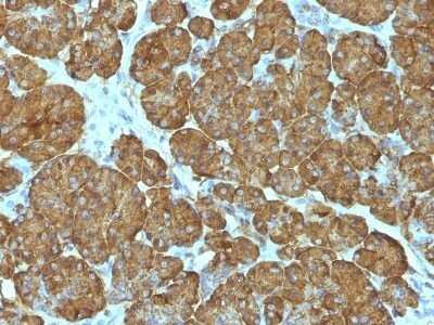 Immunohistochemistry-Paraffin: Cytochrome c Antibody (CYCS/1010) - IHC-Prediluted [NBP2-48163]