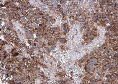 Immunohistochemistry-Paraffin: Cytochrome c Antibody [NBP2-21569]