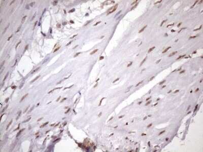 Immunohistochemistry: LIPT2-AS1 Antibody (OTI4C7) - Azide and BSA Free [NBP2-71949]