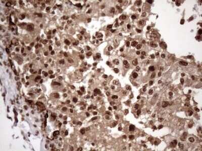 Immunohistochemistry: LIPT2-AS1 Antibody (OTI4C7) - Azide and BSA Free [NBP2-71949]