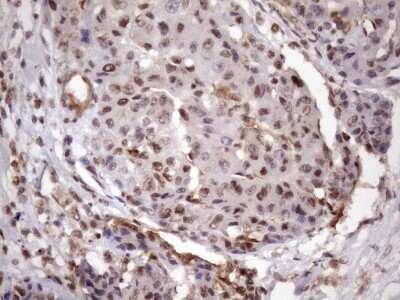 Immunohistochemistry: LIPT2-AS1 Antibody (OTI4C7) - Azide and BSA Free [NBP2-71949]