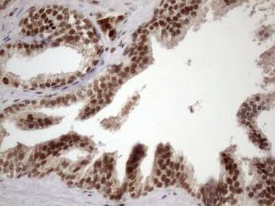 Immunohistochemistry: LIPT2-AS1 Antibody (OTI4C7) - Azide and BSA Free [NBP2-71949]